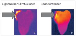 With TouchWhite™ only the gel is heated (a), while with standard laser whitening the entire tooth is heated (b).